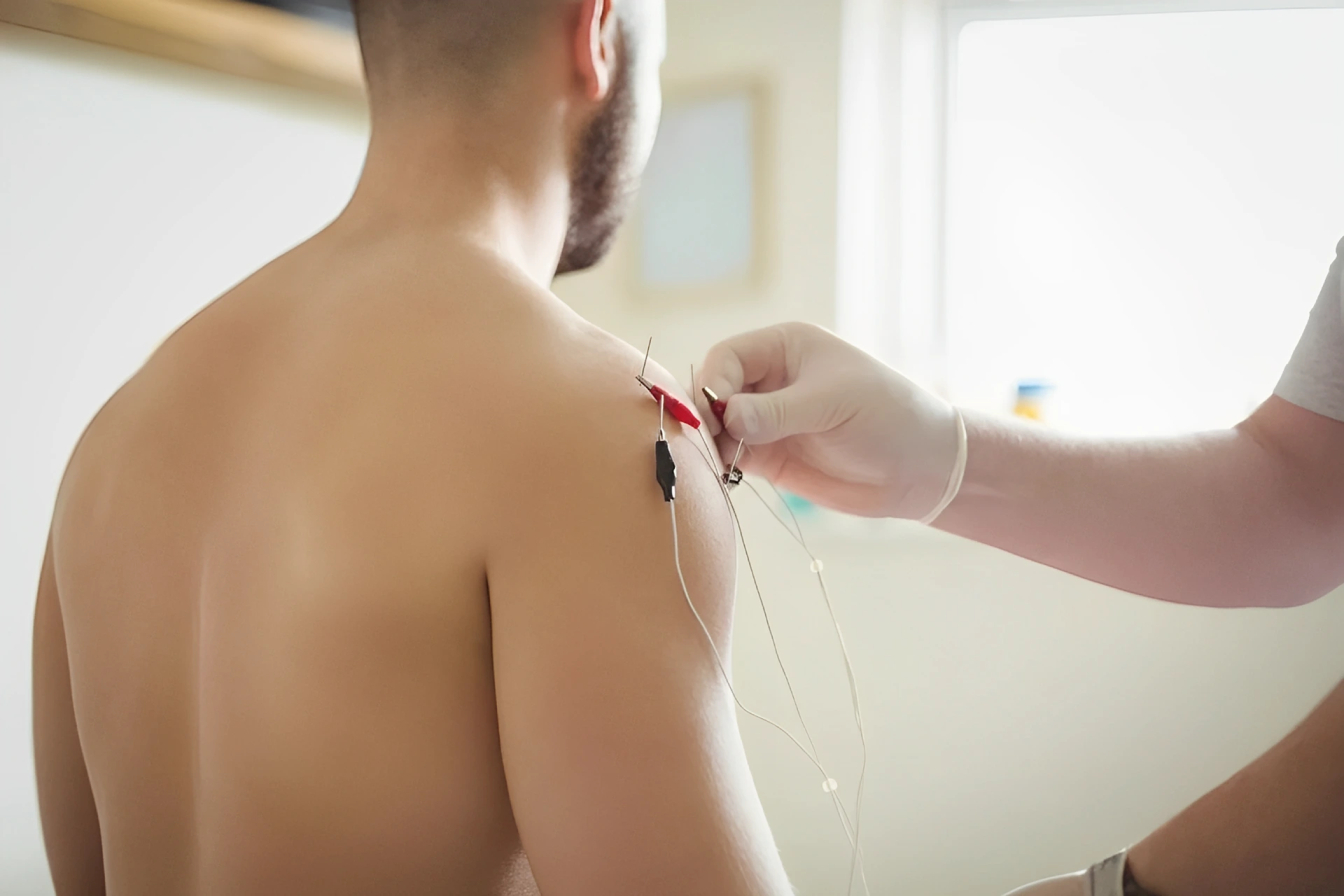 Electrical needling